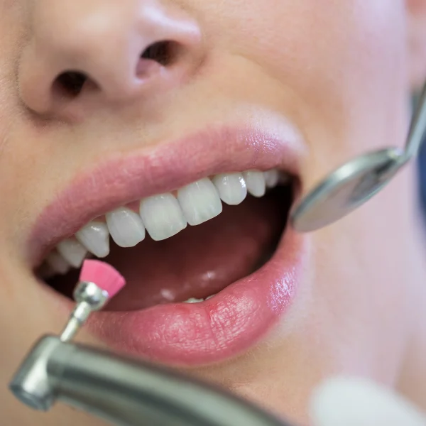 Dental Cleaning